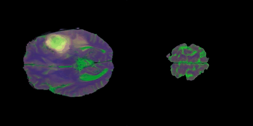 T1, T2, FLAIR-Stacked Brain MRI Generation using StyleGAN2